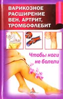 Васильева Я. Варикозное расширение вен, артрит, тромбофлебит. Чтобы ноги не болели 978-617-594-374-8