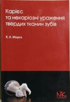 Мороз К. А. Карієс та некаріозні ураження твердих тканин зубів : навч. посібник 978-966-382-385-0
