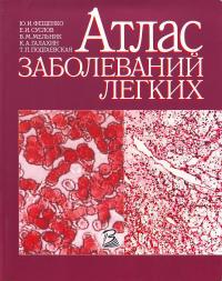Фещенко Ю. Атлас захворювань легенів 5-311-01251-х